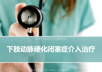 下肢动脉硬化闭塞症介入治疗课件