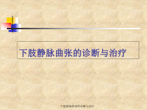 下肢静脉曲张的诊断与治疗课件