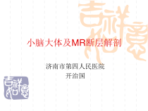 小脑大体及MR断层解剖医学课件