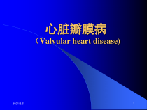 心瓣膜病医学知识学习课件