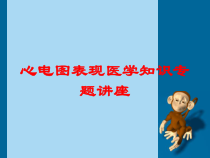 心电图表现医学知识专题讲座培训课件