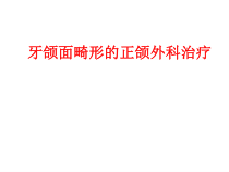 牙颌面畸形的正颌外科治疗课件