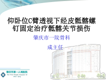 仰卧位C臂透视下经皮骶髂螺钉固定治疗骶髂关节损伤概要课件