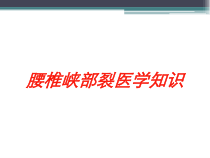 腰椎峡部裂医学知识培训课件
