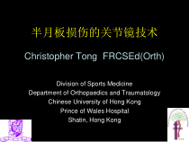 医学半月板损伤的关节镜技术中文课件