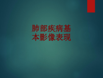 医学肺部疾病基本影像表现培训课件