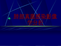 医学肺部真菌感染影像学分析培训课件