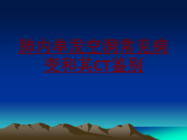 医学肺内单发空洞常见病变和其CT鉴别培训课件