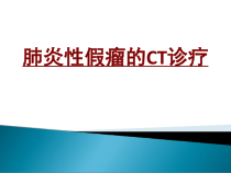 医学肺炎性假瘤的CT诊疗培训课件