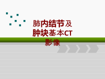 医学肺内结节及肿块基本CT影像培训课件