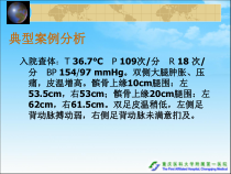 医学课件横纹肌溶解症讲解
