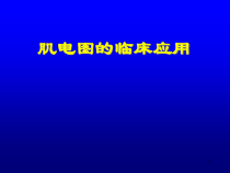 医学课件-肌电图的临床应用教学课件