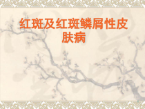 医学课件-红斑丘疹性皮肤病教学课件