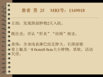 医学课件淋巴管囊肿专业医学知识宣讲