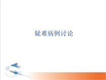 医学课件-腮腺混合瘤影像学表现课件