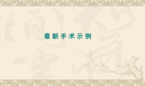 医学课件手术示例