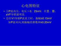 医学课件心电图典型图谱
