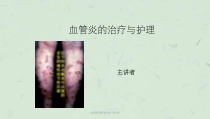 血管炎患者的治疗与护理课件
