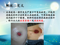 尿路造口患者的护理课件