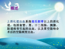 上消化道大出血的护理课件