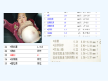 肾病综合症护理查房课件