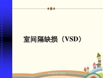 室间隔缺损护理查房课件