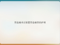 胃造瘘术后留置胃造瘘管的护理ppt培训讲义课件