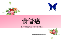 新版食管癌护理PPT课件