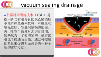 医学课件VSD负压封闭引流技术护理查房