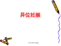 异位妊娠的护理ppt-ppt课件