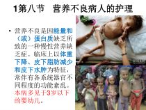 营养不良病人的护理ppt(完整版)课件