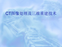 图像处理及三维重建的综述课件