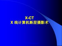 XCTX线计算机断层摄影术课件